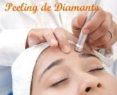Peeling diamantado 5 sessões